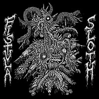 Fistula