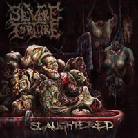 Severe Torture