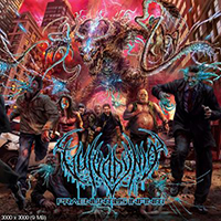 Vulvodynia