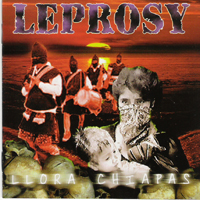 Leprosy