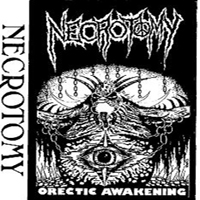 Necrotomy